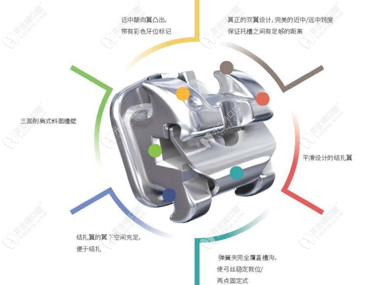 美国登士柏金属自锁矫正的特点